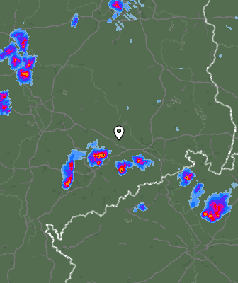Radar