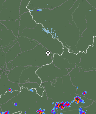 Radar