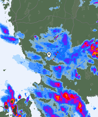 Radar