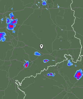 Radar