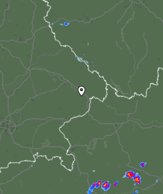 Radar