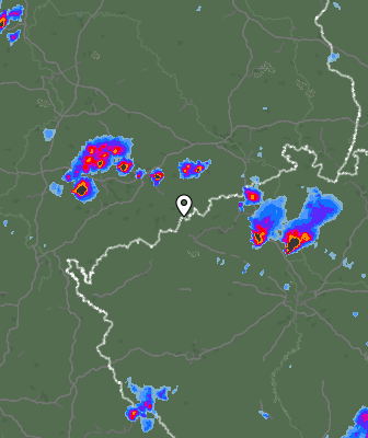 Radar