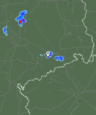 Radar