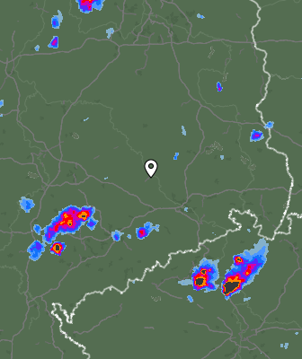 Radar