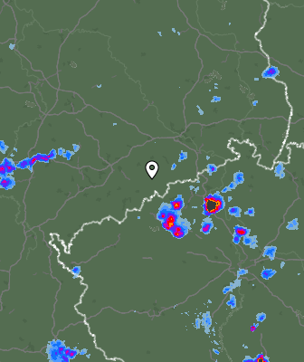 Radar