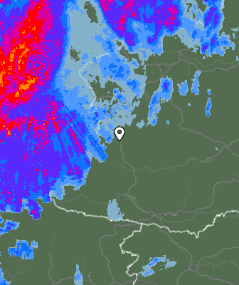 Radar