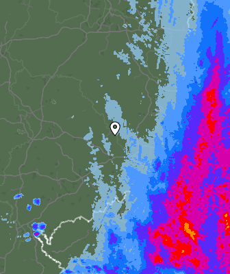 Radar