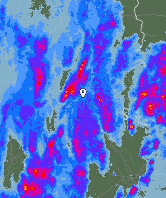 Radar