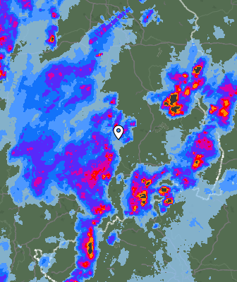 Radar