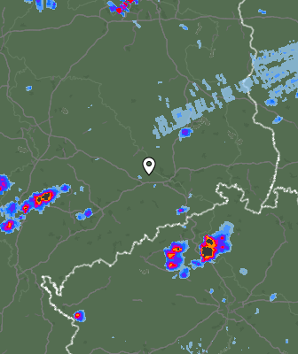 Radar