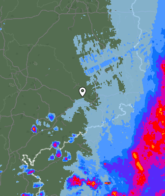 Radar
