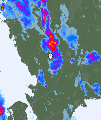 Radar