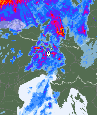 Radar