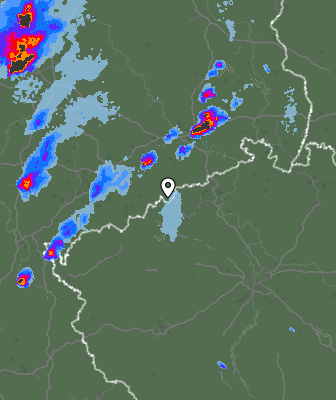 Radar