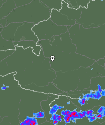 Radar