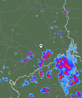 Radar