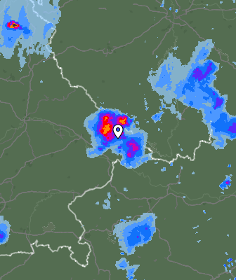 Radar