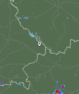 Radar