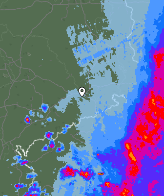 Radar