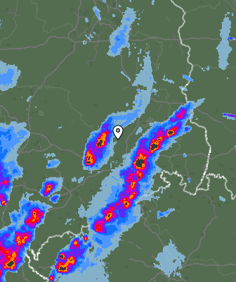 Radar