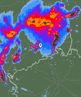 Radar