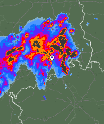 Radar