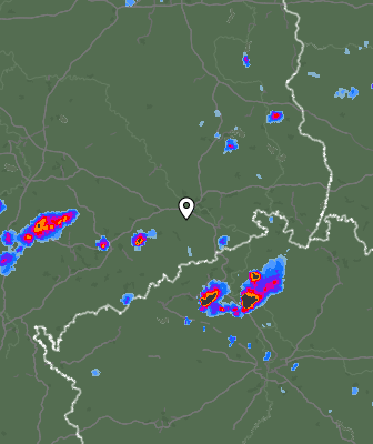 Radar