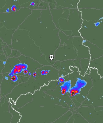Radar