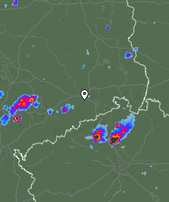 Radar