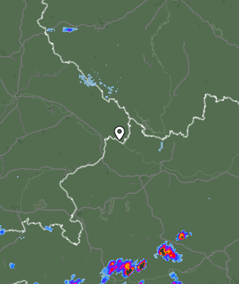 Radar