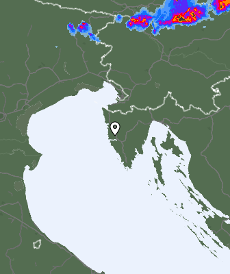 Radar