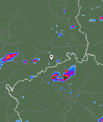 Radar