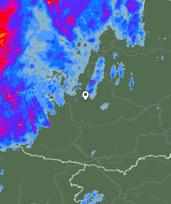 Radar