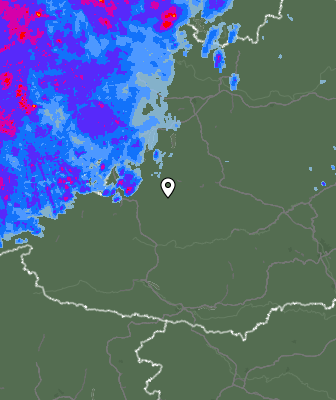 Radar