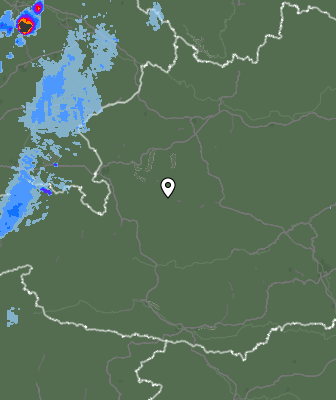 Radar