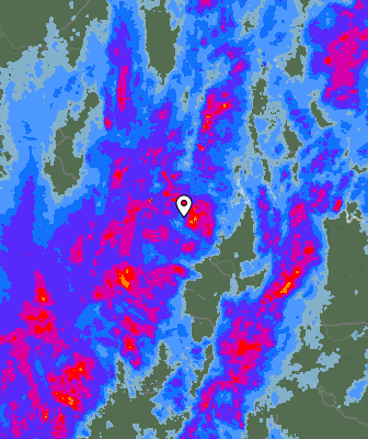 Radar