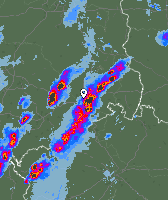 Radar