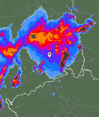 Radar