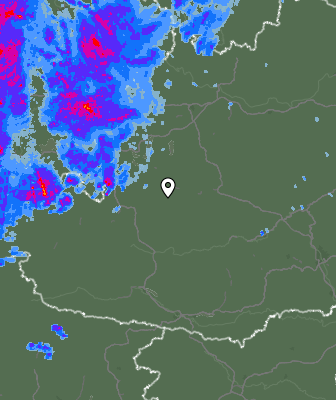 Radar