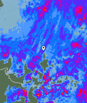Radar