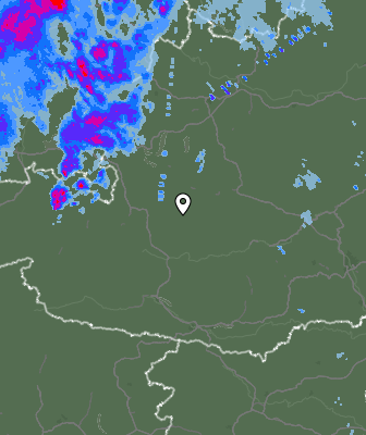 Radar