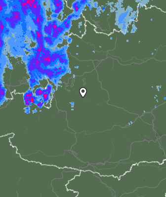 Radar