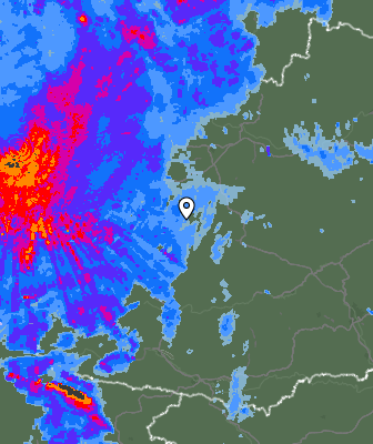 Radar