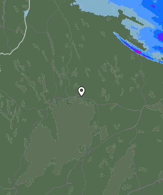 Radar