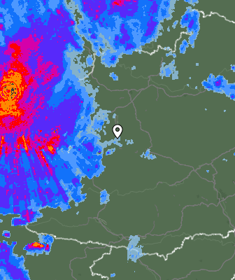 Radar