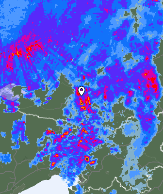 Radar