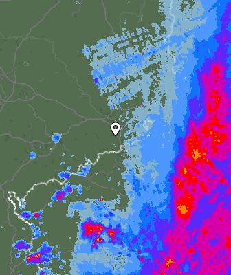 Radar