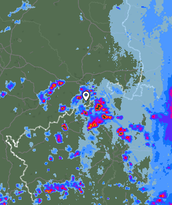 Radar