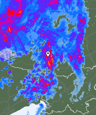 Radar