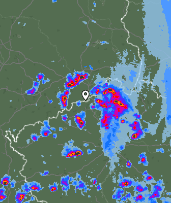 Radar